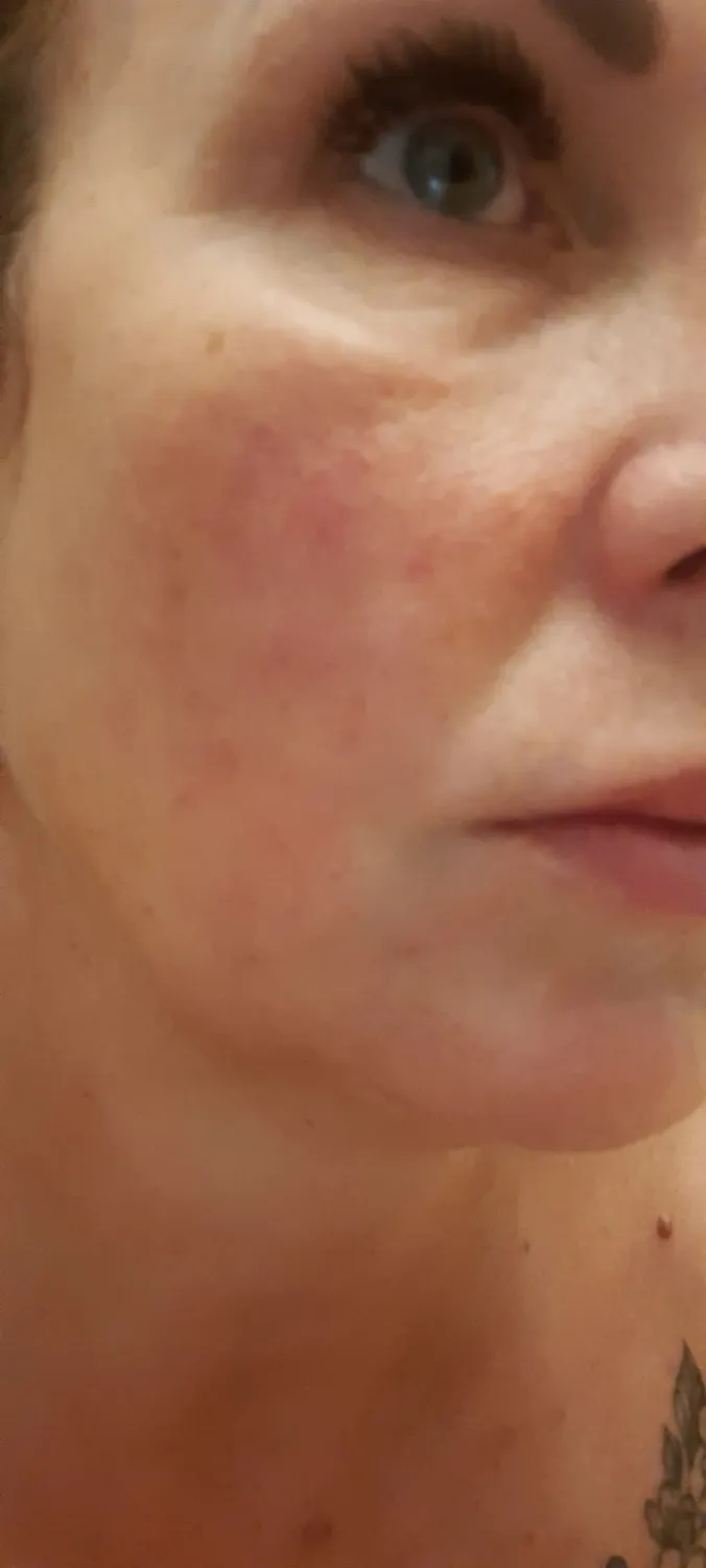 UB Kollagen & Elastin Ultraschallgel 500ml straffend