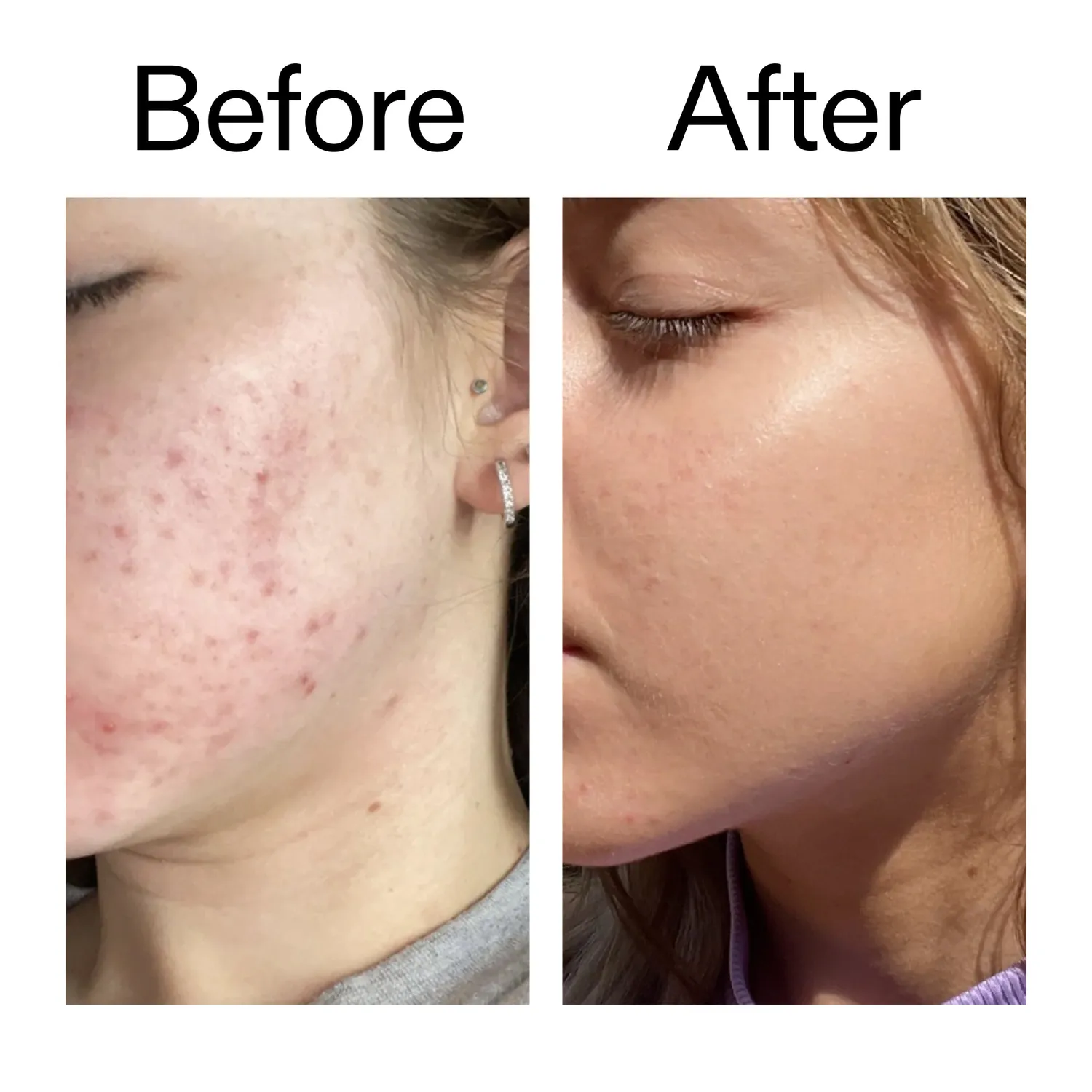 The INKEY List 10% Niacinamide Serum 30ml für ölige Haut