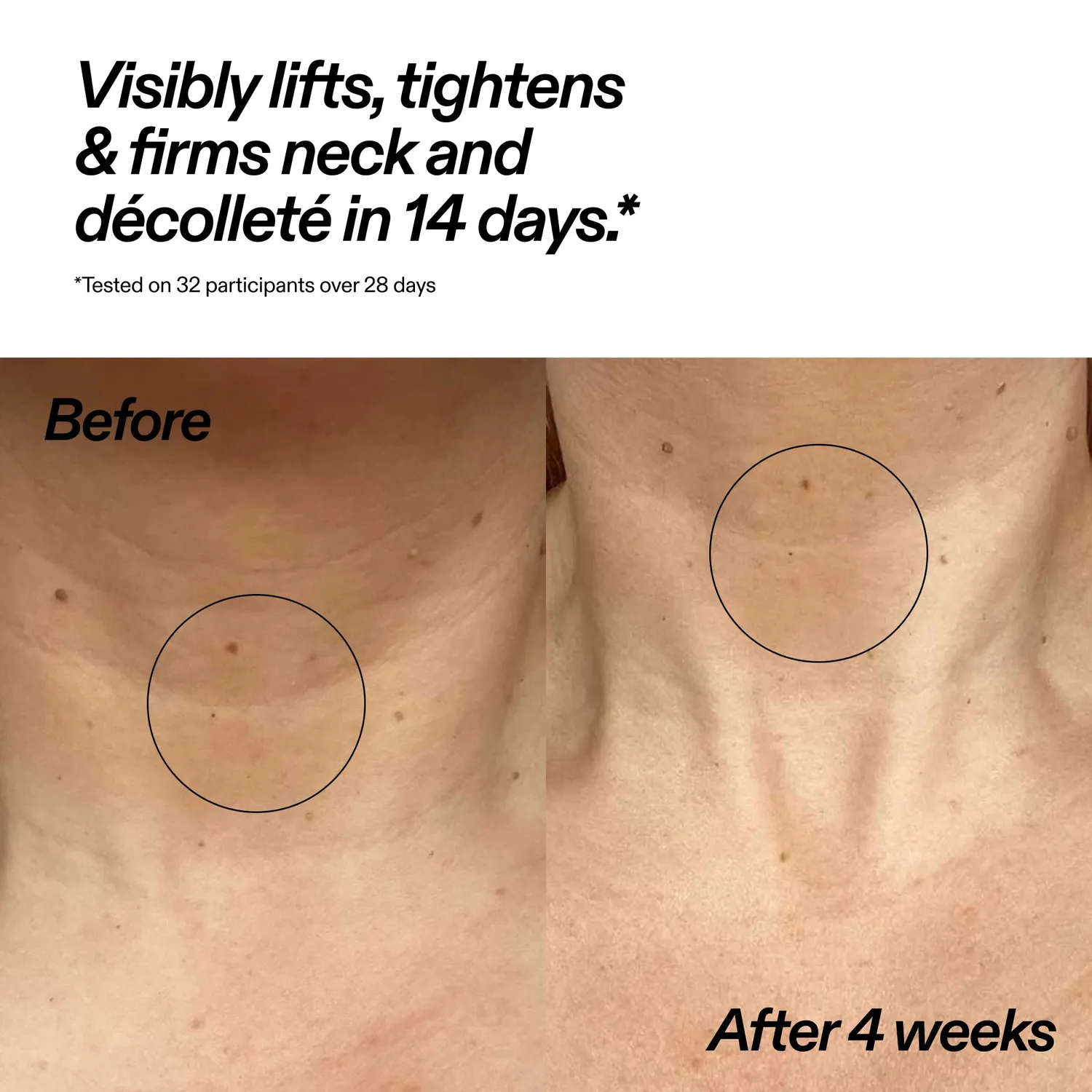 The INKEY List Bio-Active Ceramide Neck Stick 20g feste Pflege