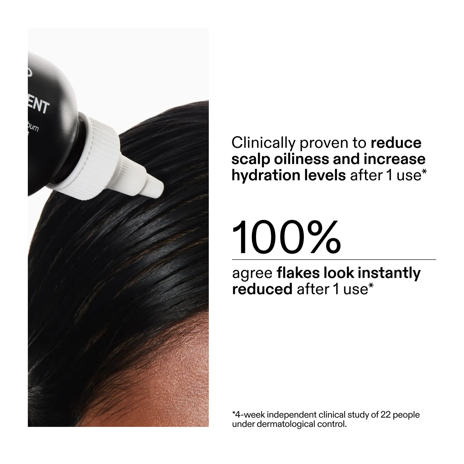 The INKEY List Salicylic Acid Kopfhaut-Peeling bei Schuppen
