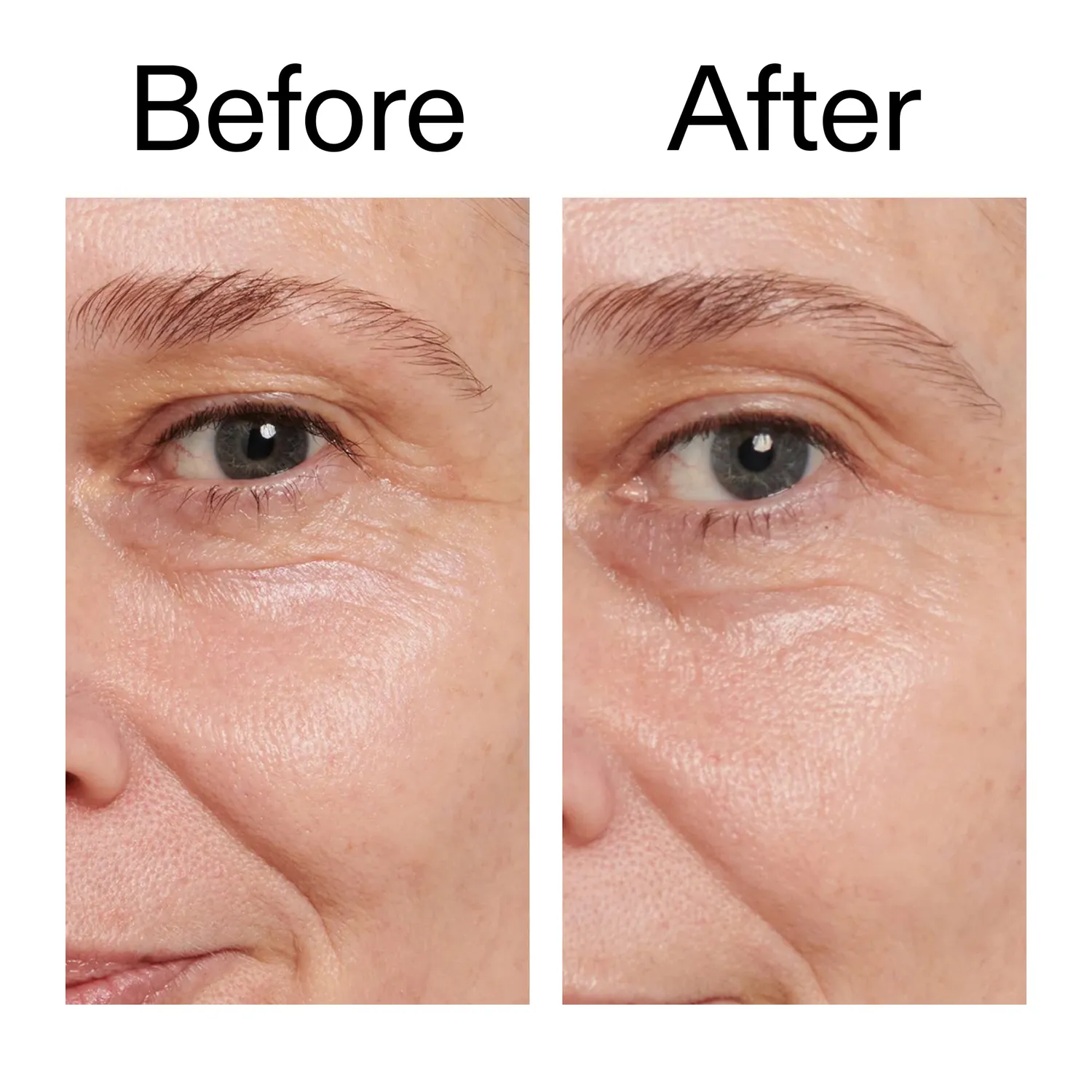 The INKEY List Retinol Eye Cream Augencreme 15 ml mit Vitamin A