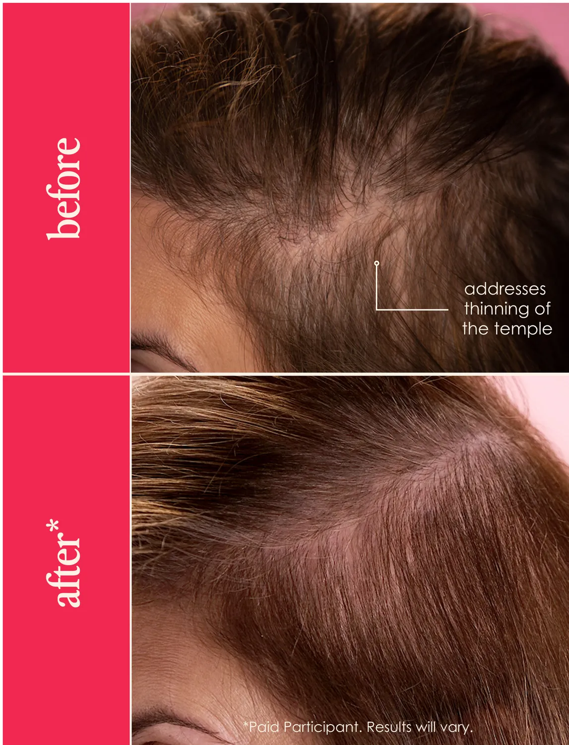 Grande Cosmetics GrandeHAIR Haarserum 40 ml für die Kopfhaut