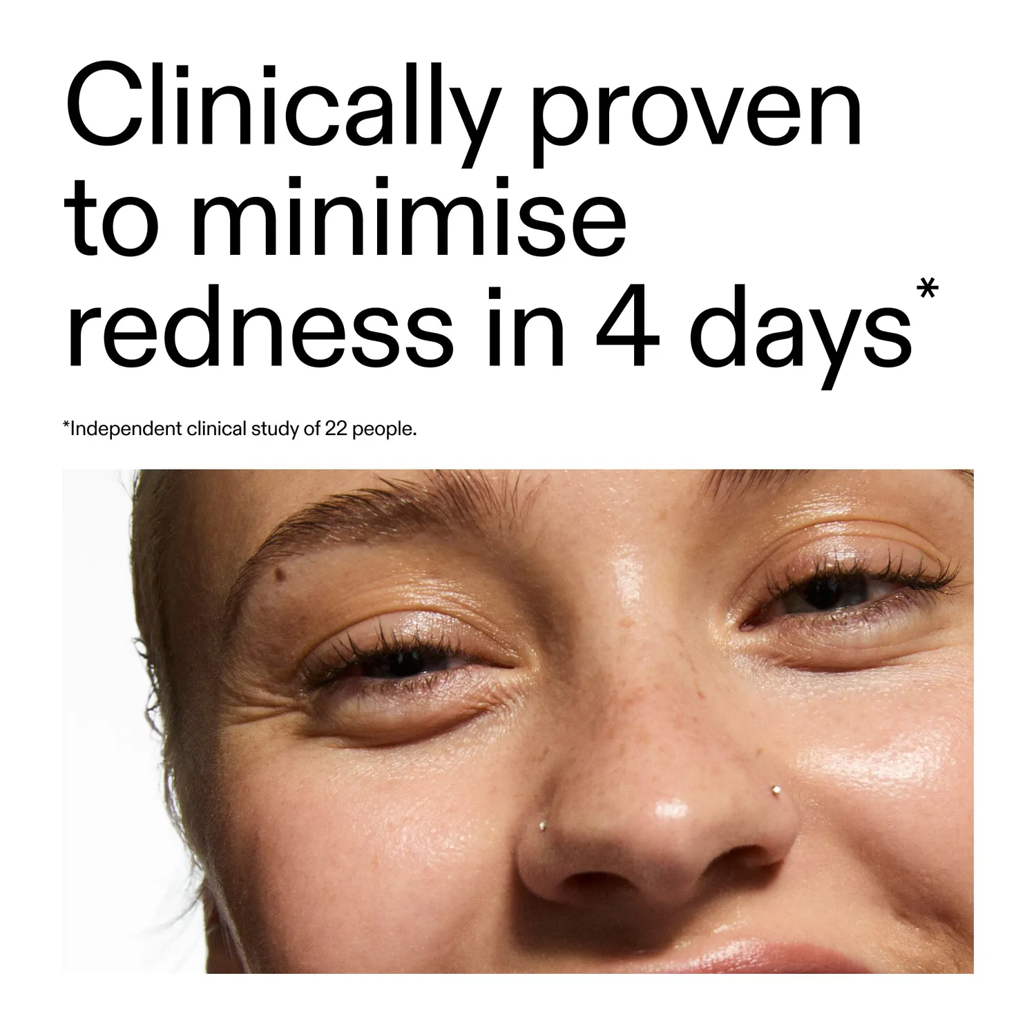 The INKEY List 10% Azelaic Acid Serum Rötungen 30ml
