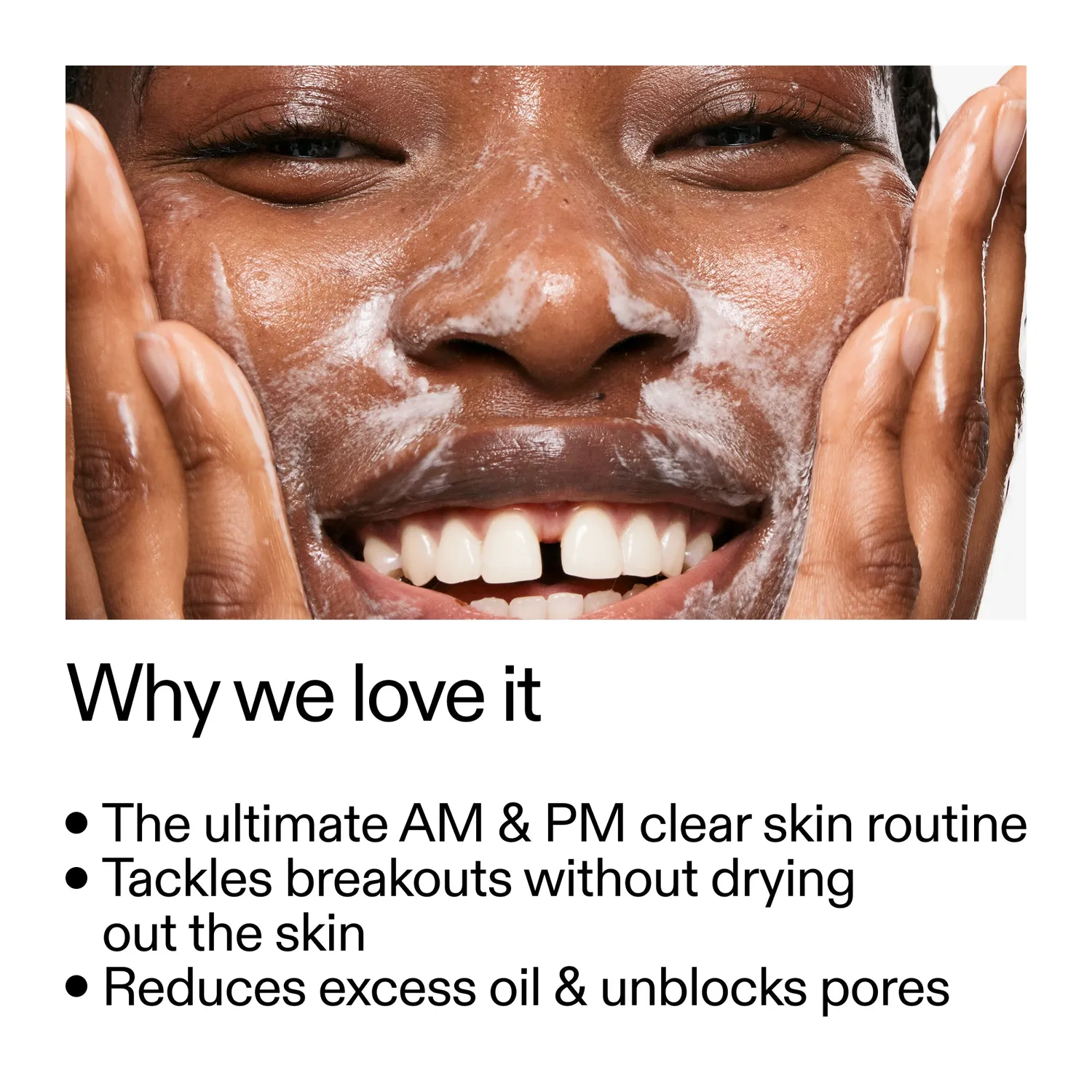 The INKEY List Intro Routine for Acne Pflegeset gegen Pickel